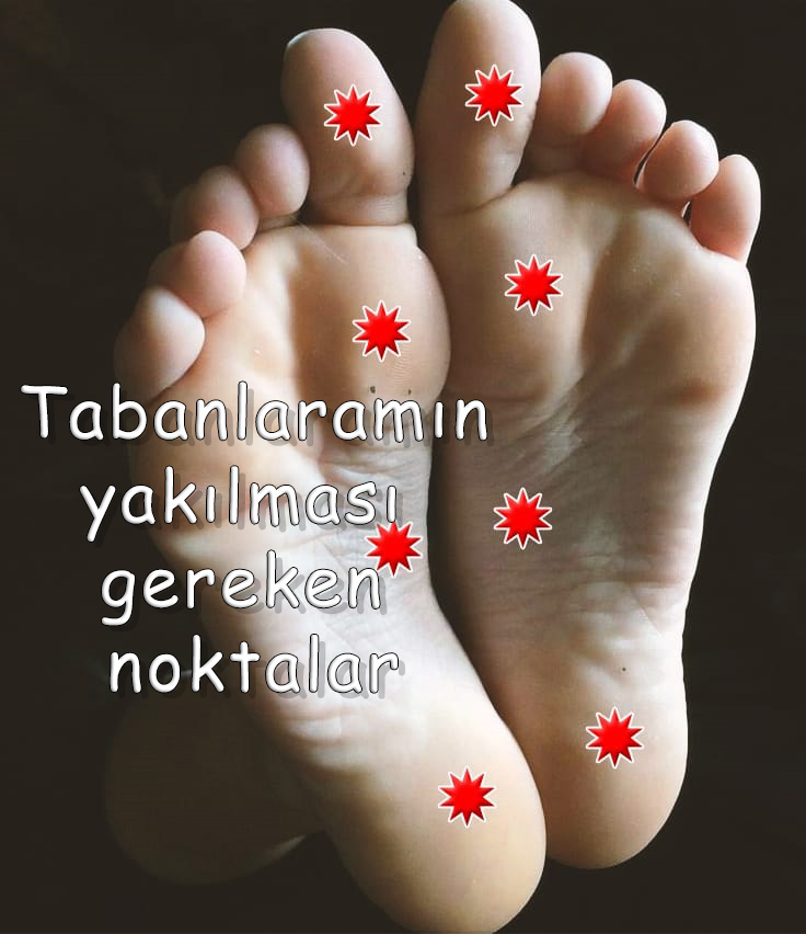 Taban yakma noktaları